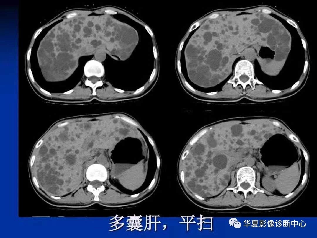 鞋帽 第33页